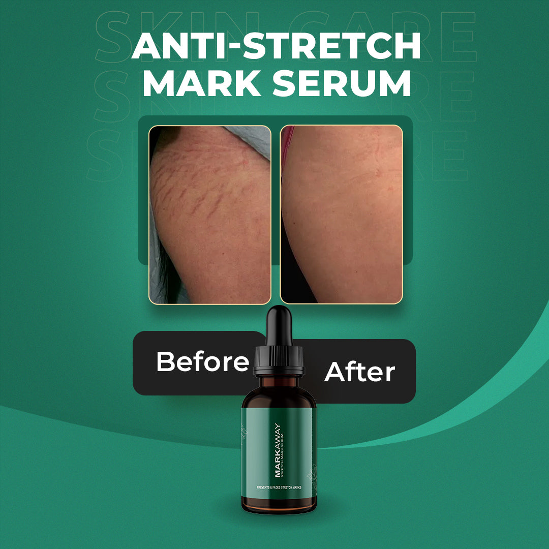 Markaway Stretch Mark Serum - Image 3