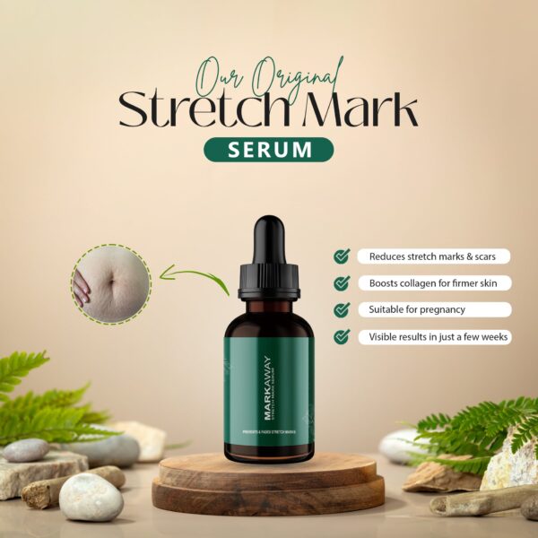 Markaway Stretch Mark Serum - Image 4