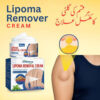 Lipoma Removal Cream
